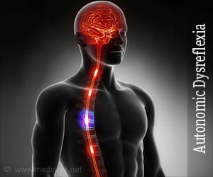 Autonomic Dysreflexia - Causes, Symptoms, Diagnosis, Treatment, Prevention