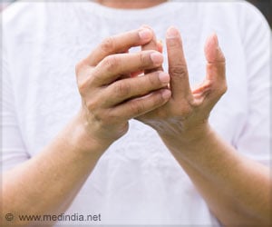 Beriberi Disease - Causes, Risk Factors, Symptoms, Diagnosis, Treatment, Prognosis