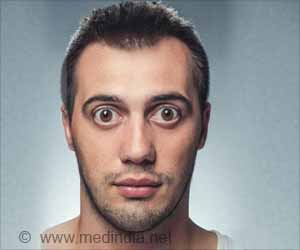 Bulging Eyes | Eye Proptosis | Exophthalmos - Causes, Symptoms, Diagnosis and Treatment