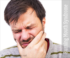 Burning Mouth Syndrome - Causes, Symptoms, Diagnosis, Treatment, Prevention