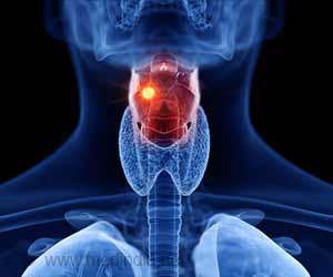 Cancer of Larynx (Throat Cancer)-Risk Factors-Symptoms-Diagnosis-Treatment