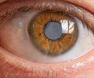 About Cataract 