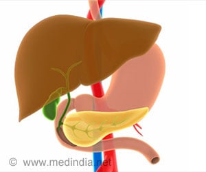 Cholestatic Jaundice - Causes, Symptoms, Risk Factors, Diagnosis, Treatment & Prevention