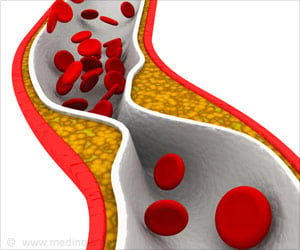 Cholesterol - The Enigma Chemical - Myths - Diet - Functions