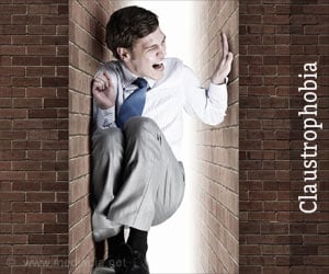 Claustrophobia - Causes, Symptoms, Diagnosis, Treatment, Prevention