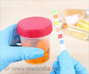 What Does the Color and Odor of Your Urine Say About Your Health