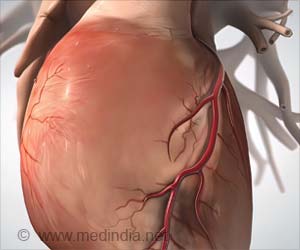 Coronary Artery Bypass Grafting (CABG) | Coronary Artery Bypass Surgery