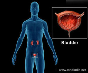 Cystitis - Causes - Symptoms - Diagnosis - Treatment -  FAQs