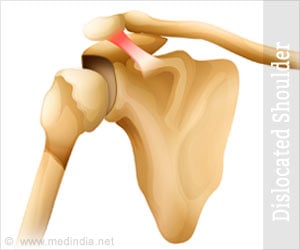 Dislocated Shoulder - Symptoms, Diagnosis, Treatment