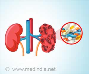 Drug-Induced Kidney Disease | Nephrotoxicity