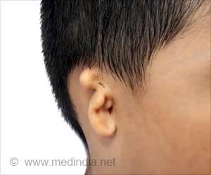 Ear Deformities