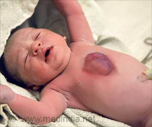 Ectopia Cordis - Causes, Symptoms, Diagnosis, Complications, Treatment & Prognosis