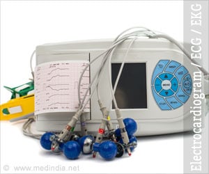 Electrocardiogram | ECG | EKG