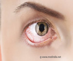 Eye Pain - Symptom Evaluation