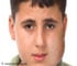 Facial Swelling Symptom Evaluation