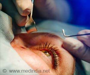 Floppy Iris Syndrome - Causes, Symptoms, Treatment, Risk Factors, Prevention & Prognosis