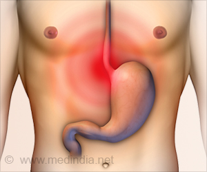 Foods to Avoid to Keep Acid Reflux At Bay