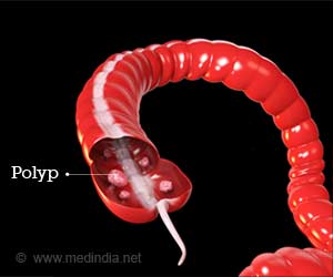 Gardner Syndrome | Familial Adenomatous Polyposis (FAP) - Causes, Symptoms, Diagnosis, Treatment and Risk Factors