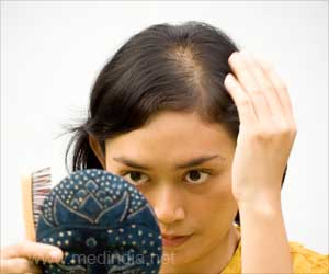 Hair Loss | Alopecia in Women