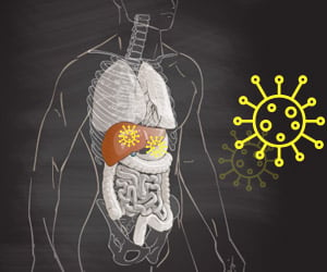 Hepatitis C - Causes, Symptoms, Diagnosis, Treatment, Complications, Prevention