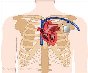 Implantable Cardioverter Defibrillator - Indications, Advantages and Risks