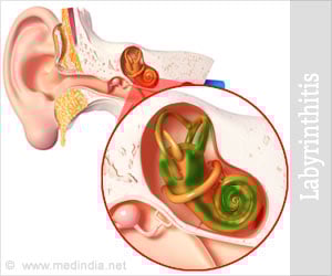 Labyrinthitis - Symptoms, Causes, Diagnosis, Treatment, Prognosis