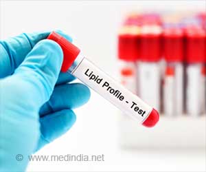 Lipid Profile | Cholesterol Testing | Lipid Panel