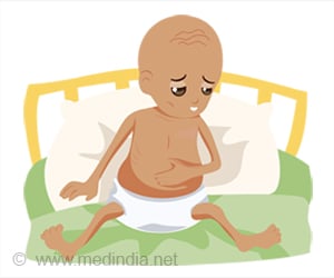 Marasmus | Protein-Energy Malnutrition - Causes, Symptoms, Diagnosis, Treatment and Prevention
