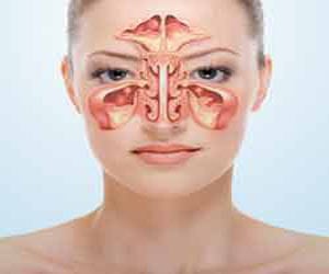 Cancer of Maxillary Sinus/Paranasal Sinuses-Symptoms-Diagnosis-Treatment-Prevention