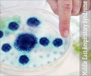 Middle East Respiratory Syndrome (MERS) - Causes Symptoms Treatment Prevention