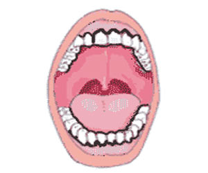 Oral Health and AIDS - Introduction Treatment FAQs