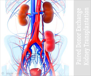 Paired Donor Exchange Kidney Transplantation