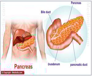 Pancreatitis