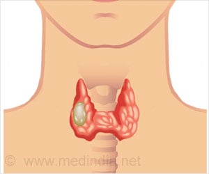Papillary Thyroid Cancer - Types, Risk Factors, Diagnosis, Treatment