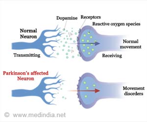 Parkinson’s Disease - Causes, Symptoms, Diagnosis, Treatment