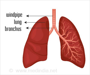 Pneumonia - Causes, Symptoms, Diagnosis, Treatment, Prevention, Complications