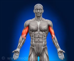 Polymyositis - Types, Causes, Symptoms, Complications, Diagnosis, Treatment