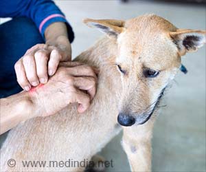Rabies - Types, Causes, Symptoms, Diagnosis, Treatment & Prevention