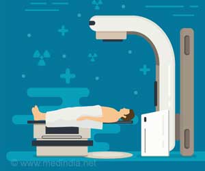 Radiosurgery | Stereotactic Ablative Radiotherapy (SABR) | Stereotactic Radiosurgery (SRS)
