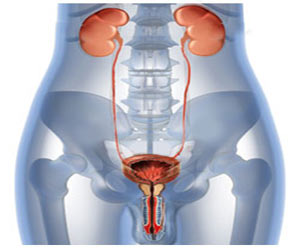 Reactive Arthritis - Symptoms - Causes - Diagnosis - Treatment