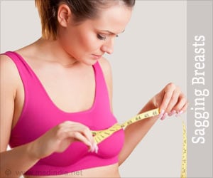 Sagging Breasts - Causes, Symptoms, Diagnosis, Prevention