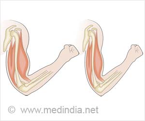 Sarcopenia - Causes, Symptoms, Diagnosis, Complications, Treatment & Prevention