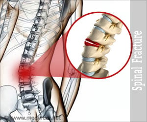 Spinal Fracture - Causes, Symptoms, Diagnosis, Treatment