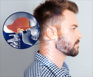 Temporomandibular Joint Disorders - Causes, Symptoms, Diagnosis & Treatment