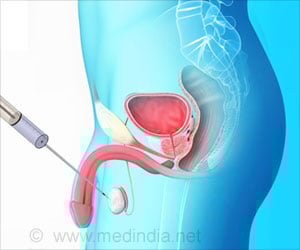 Testicular Biopsy - Types, Procedure, Precautions, Risks & Results