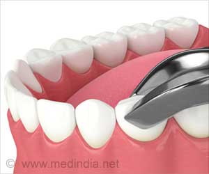 Dental | Tooth Extraction