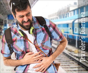 Traveler''s Diarrhea - Causes, Symptoms, Treatment, Prevention & Health Tips