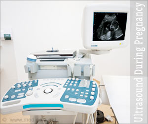 Ultrasound During Pregnancy - Prepare, Procedure, Types