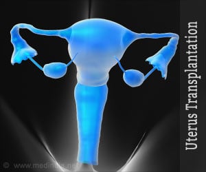 Uterus Transplantation / Womb Transplantation - Advantages and Disadvantages