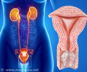 Vaginal Discharge - Symptom Evaluation